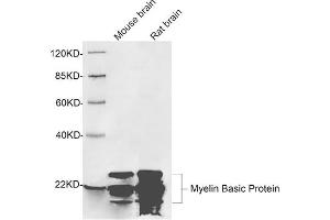 Image no. 1 for anti-Myelin Basic Protein (MBP) (C-Term) antibody (ABIN1574105)