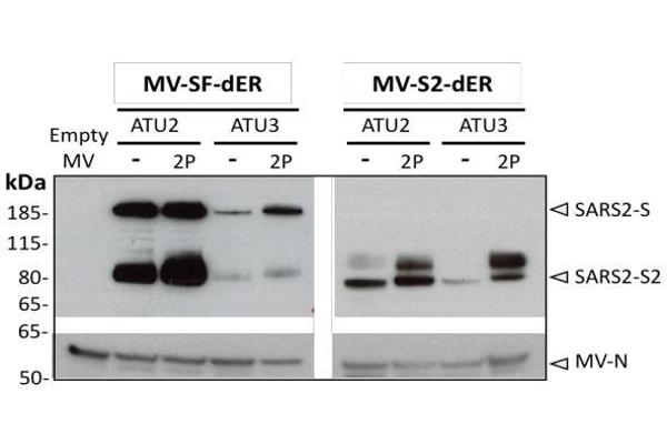 anti-SARS-Coronavirus Spike Protein (SARS-CoV S) (AA 1124-1140) antibody