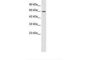 Image no. 2 for anti-Zinc Finger Protein 12 (ZNF12) (AA 73-122) antibody (ABIN202669)