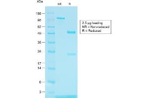 Image no. 1 for anti-Tyrosinase-Related Protein 1 (TYRP1) antibody (ABIN6940841)