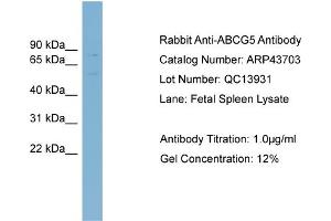 Image no. 2 for anti-ATP-Binding Cassette, Sub-Family G (WHITE), Member 5 (ABCG5) (Middle Region) antibody (ABIN2781532)