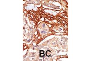 Image no. 2 for anti-V-Raf Murine Sarcoma 3611 Viral Oncogene Homolog (ARAF) (AA 256-286) antibody (ABIN392244)