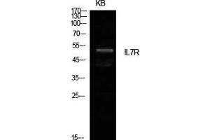 Image no. 2 for anti-Interleukin 7 Receptor (IL7R) (Internal Region) antibody (ABIN3181445)