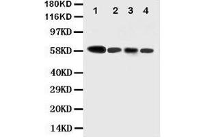Image no. 2 for anti-Caspase 10, Apoptosis-Related Cysteine Peptidase (CASP10) (AA 220-236), (N-Term) antibody (ABIN3044426)