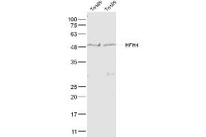 Image no. 3 for anti-Forkhead Box J1 (FOXJ1) (AA 161-260) antibody (ABIN734288)