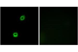 Image no. 2 for anti-Myristoylated Alanine-Rich Protein Kinase C Substrate (MARCKS) (AA 126-175) antibody (ABIN1532929)