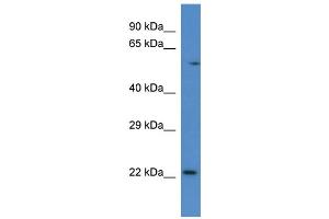 Image no. 2 for anti-RAB10, Member RAS Oncogene Family (RAB10) (C-Term) antibody (ABIN2779379)