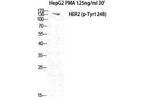 Image no. 2 for anti-Neuralized Homolog (Drosophila) (NEURL) (pTyr1248) antibody (ABIN3182077)