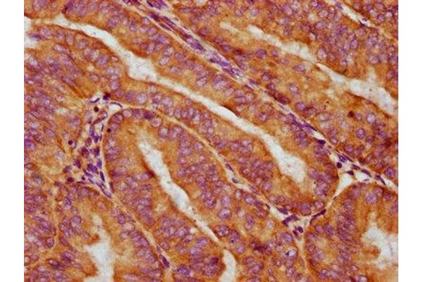 Cytokeratin 2 anticorps  (AA 173-283)