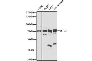 Image no. 1 for anti-SET Domain Containing 3 (SETD3) antibody (ABIN6571549)