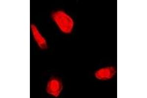 Image no. 1 for anti-Fanconi Anemia, Complementation Group C (FANCC) (full length) antibody (ABIN6004256)