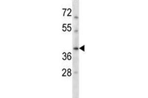 Image no. 2 for anti-DNA Repair Protein RAD51 Homolog 3 (RAD51C) (AA 169-198) antibody (ABIN3032429)