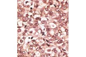 Image no. 2 for anti-Toll-Like Receptor 6 (TLR6) (C-Term) antibody (ABIN357053)