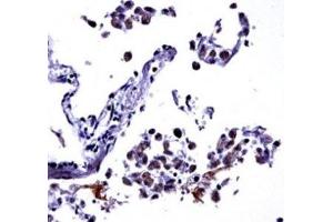 IL-13 antibody immunohistochemistry analysis in formalin fixed and paraffin embedded human lung tissue.