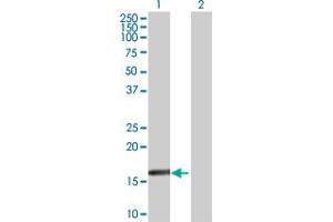 anti-Retinoic Acid Receptor Responder (Tazarotene Induced) 3 (RARRES3) (AA 1-164) antibody