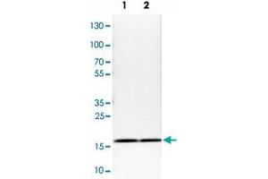 Image no. 4 for anti-Ribosomal Protein S25 (RPS25) antibody (ABIN5587182)