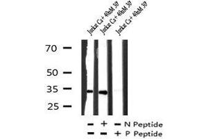 Image no. 4 for anti-Myogenic Differentiation 1 (MYOD1) (pThr115) antibody (ABIN6269879)