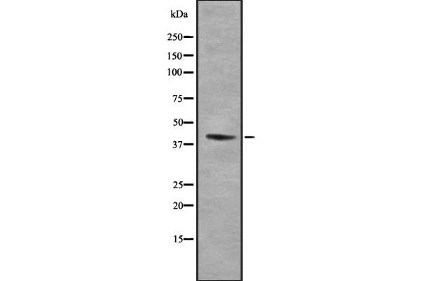 RIMKLB antibody  (Internal Region)