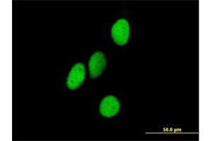 Immunofluorescence of purified MaxPab antibody to ORC4L on HeLa cell.