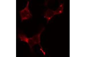 Image no. 2 for anti-Y Box Binding Protein 1 (YBX1) antibody (ABIN6266077)