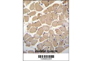Image no. 1 for anti-Growth Arrest-Specific 2 Like 2 (GAS2L2) (AA 763-791), (C-Term) antibody (ABIN655364)