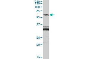 Image no. 2 for anti-Sialic Acid Acetylesterase (SIAE) (AA 1-523) antibody (ABIN527056)