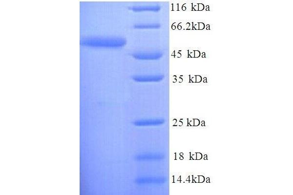 D-Serine Dehydratase (DSDA) (AA 1-440), (full length) protein (His tag)