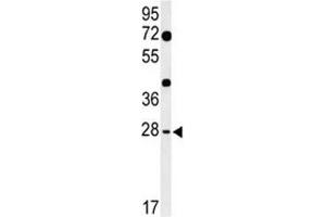 Image no. 1 for anti-Hairy and Enhancer of Split 7 (HES7) (AA 26-55) antibody (ABIN3028694)