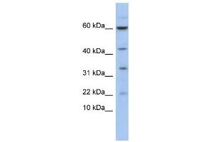 Image no. 1 for anti-LIM Domain Only 2 (Rhombotin-Like 1) (LMO2) (N-Term) antibody (ABIN2792668)