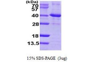 Image no. 1 for Sirtuin 2 (SIRT2) (AA 1-352) protein (His tag) (ABIN6386645)