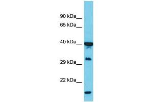 Image no. 6 for anti-Poly(rC) Binding Protein 1 (PCBP1) (Middle Region) antibody (ABIN2778971)