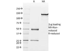 Mammaglobin A antibody