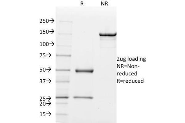 Mammaglobin A antibody