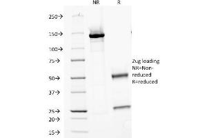 Image no. 3 for anti-Major Vault Protein (MVP) antibody (ABIN6941285)