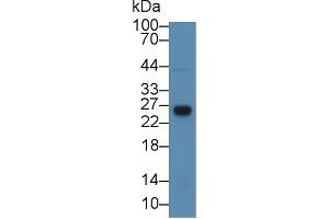 Image no. 2 for anti-Glutathione S-Transferase theta 1 (GSTT1) (AA 7-231) antibody (ABIN1868285)