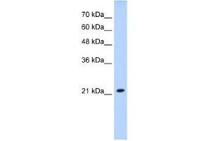 anti-Solute Carrier Family 25 (Mitochondrial Carrier, Brain), Member 14 (SLC25A14) antibody