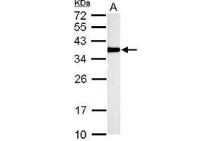 Image no. 2 for anti-Thiosulfate Sulfurtransferase (Rhodanese) (TST) (Center) antibody (ABIN2856290)