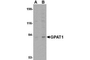 Image no. 2 for anti-Glycerol-3-Phosphate Acyltransferase, Mitochondrial (GPAM) (C-Term) antibody (ABIN499910)