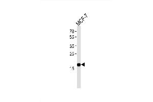 Image no. 2 for anti-Non-Metastatic Cells 1, Protein (NM23A) Expressed in (NME1) antibody (ABIN1882270)