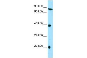 anti-Tetratricopeptide Repeat Domain 4 (TTC4) (C-Term) antibody