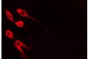 Image no. 2 for anti-Myogenic Differentiation 1 (MYOD1) (Internal Region) antibody (ABIN6263488)