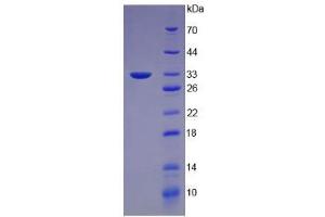 Image no. 1 for Keratin 5 (KRT5) protein (ABIN3010339)