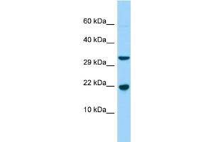 CABP5 antibody  (N-Term)
