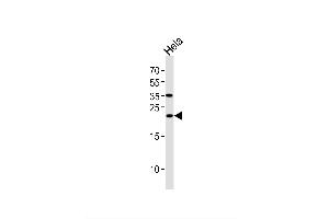 Image no. 1 for anti-Ubiquitin-Conjugating Enzyme E2T (Ube2t) antibody (ABIN1944867)