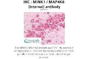 Image no. 1 for anti-Misshapen-Like Kinase 1 (MINK1) (Internal Region) antibody (ABIN1736952)