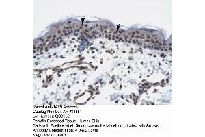 Image no. 1 for anti-RNA Polymerase II TBP-Associated Factor Subunit G (TAF9) (N-Term) antibody (ABIN2775865)