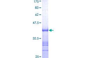Image no. 1 for Bestrophin 1 (BEST1) (AA 361-460) protein (GST tag) (ABIN1346633)