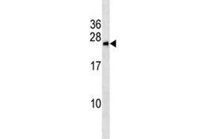 Image no. 2 for anti-BCL2/adenovirus E1B 19kDa Interacting Protein 1 (BNIP1) (AA 26-55) antibody (ABIN3028499)