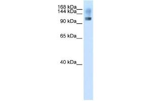 Image no. 1 for anti-Splicing Factor, Suppressor of White-Apricot Homolog (SFSWAP) (N-Term) antibody (ABIN2778897)