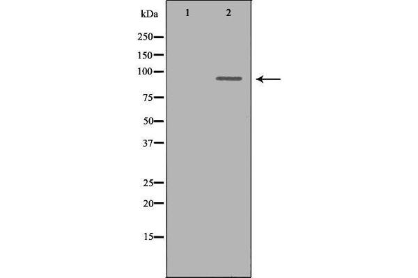 OCA2 anticorps  (N-Term)